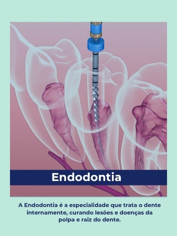 endodontia polaroid (1)