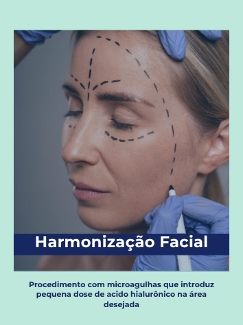harmonização facial polaroid (1)