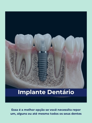 implante dentario polaroid (1)