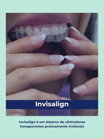 invisalign polaroid (1)