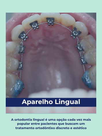 aparelho lingual polaroid